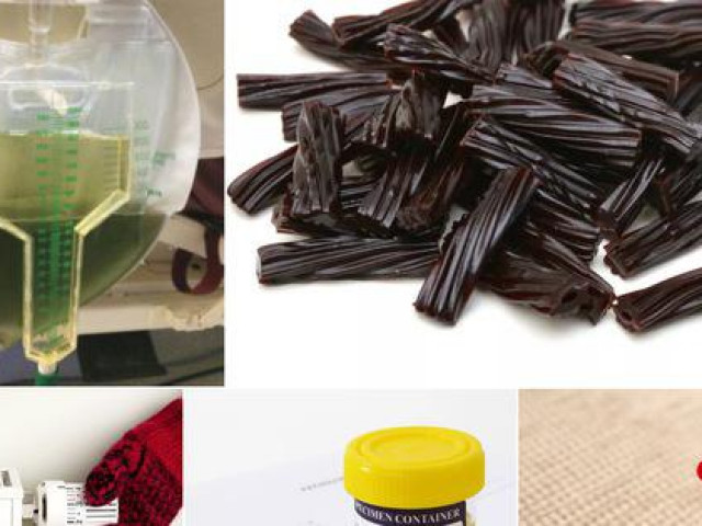 Sức khỏe đời sống - Khó tin với 5 ca bệnh gây sốc nhất năm!