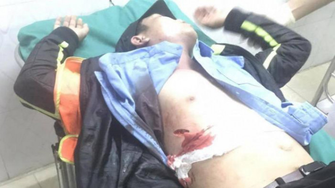 Nhân viên trạm thu phí BOT Ninh Xuân bị ông Nguyễn Phước Quang dùng dao đâm trọng thương