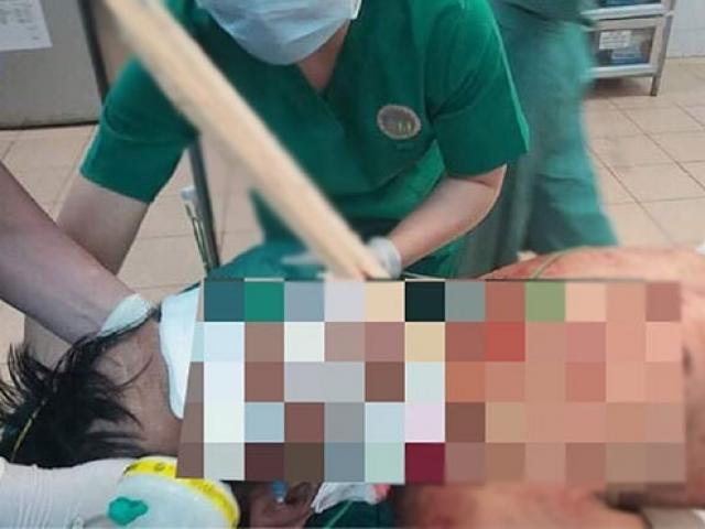 Tin tức trong ngày - Máy xẻ gỗ sặp sự cố, khúc cây găm sâu vào cổ người đàn ông