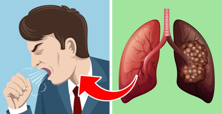 5 dấu hiệu cho thấy hai lá phổi đang “cầu cứu” - 2