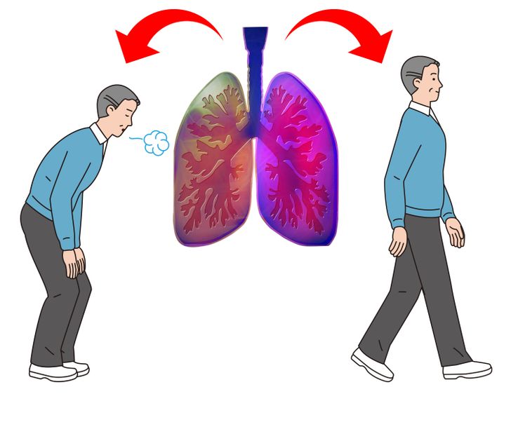 5 dấu hiệu cho thấy hai lá phổi đang “cầu cứu” - 3