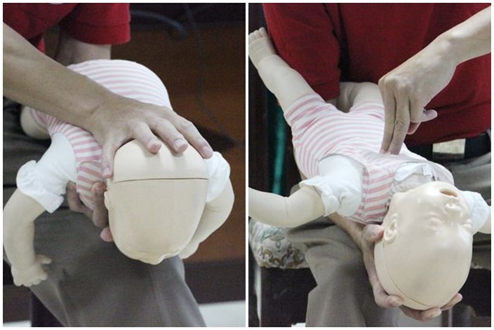 Với trẻ dưới 2 tuổi, dùng đồng thời hai phương pháp vỗ lưng ấn ngực