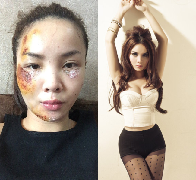 Năm 2015, Yến Trang gặp tai nạn nghiêm trọng khi đang đi lưu diễn. Nữ ca sĩ bị mất trí nhớ tạm thời và mang theo nhiều vết thương trên mặt, nên phải tạm nghỉ ca hát một thời gian. Sau khi phục hồi, người đẹp lại tiếp tục tỏa sáng trên sân khấu.
