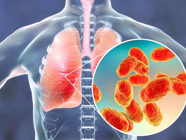 Sức khỏe đời sống - Bất ngờ với những nguyên nhân "không tưởng" làm tổn thương phổi