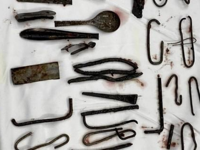 Sức khỏe đời sống - Người đàn ông có sở thích lạ ăn cả ký sắt thép đinh, kéo...