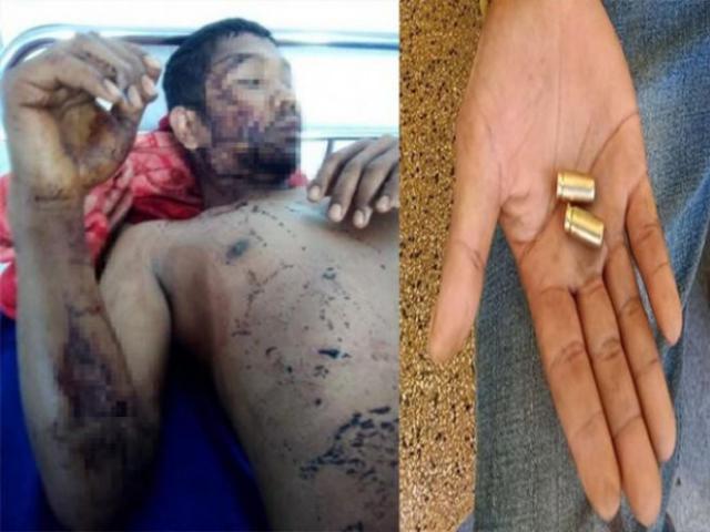 Pháp luật - Thực hư thông tin công an nổ súng bắt đánh bạc, hai thanh niên bị thương?