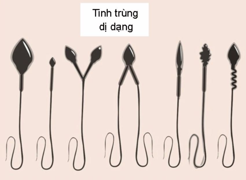 Chất lượng “tinh binh” kém là dấu hiệu nhiều bệnh, quý ông cần lưu ý kẻo "hối không kịp" - 1