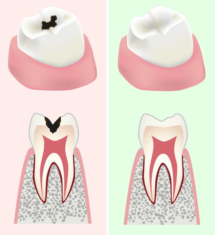 Ăn mỗi ngày 1 quả dưa chuột nhận ngay 13 lợi ích sức khỏe quý như vàng - 13