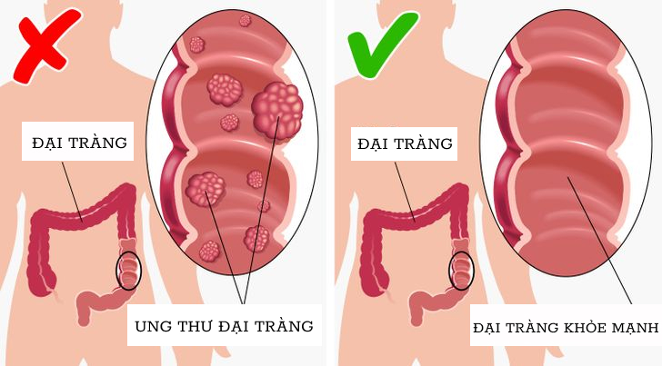 Ăn mỗi ngày 1 quả dưa chuột nhận ngay 13 lợi ích sức khỏe quý như vàng - 3