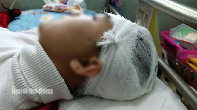 Nam sinh Phan Thanh L. bị đánh vỡ sọ não đang điều trị tại bệnh viện