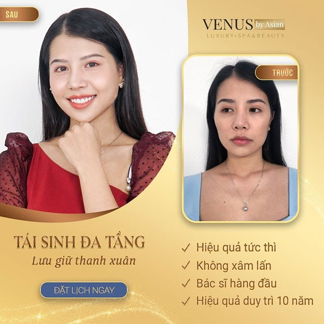 Phòng khám chuyên khoa Phẫu thuật tạo hình thẩm mỹ Venus by Asian địa chỉ làm đẹp uy tín, an toàn - 3