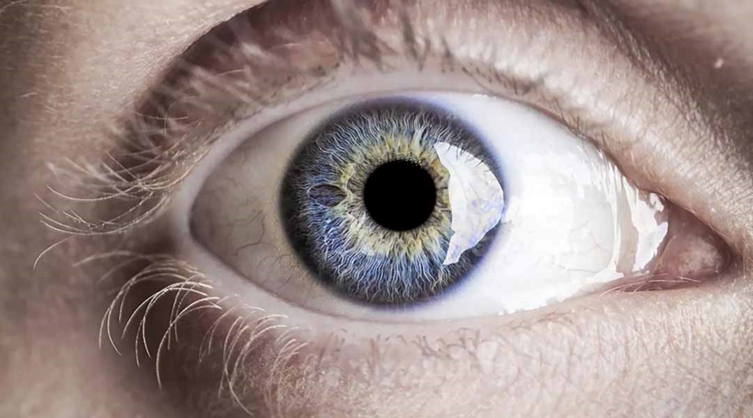 10 căn bệnh nguy hiểm được bộc lộ qua đôi mắt - 9