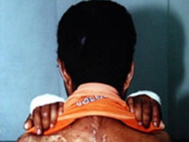 Pháp luật - Áp bàn là nóng vào ngực osin, cựu tiếp viên hàng không trả giá đắt