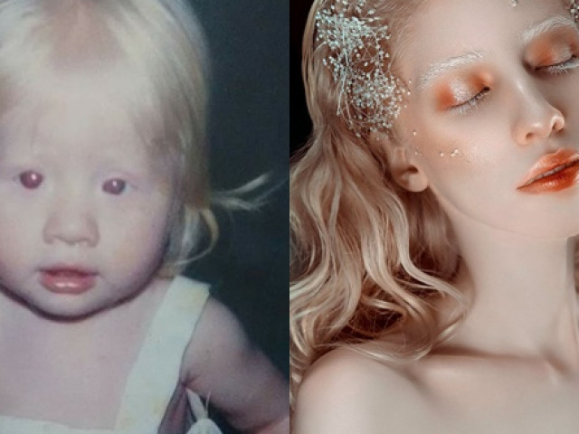 Bạn trẻ - Cuộc sống - Lúc nhỏ bị trêu "giống ma", lớn lên cô gái khiến cả thế giới ngỡ ngàng