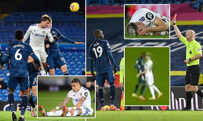 Arsenal từng may mắn cầm hòa Leeds United 0-0 ở lượt đi giải Ngoại hạng Anh mùa này khi Nicolas Pepe dính thẻ đỏ vì một cú húc đầu vào đối thủ như Zinedine Zidane