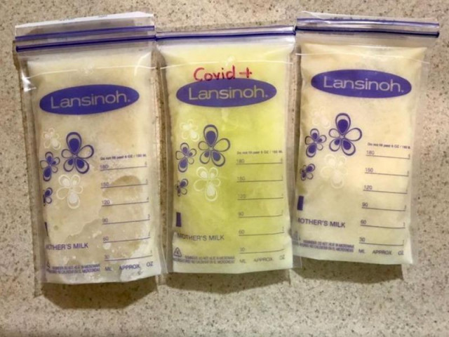 Thế giới - Sữa mẹ bỗng chuyển màu xanh lá sau khi mẹ nhiễm COVID-19