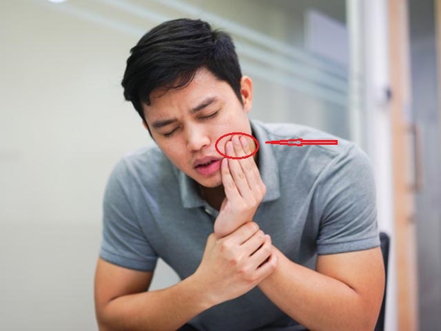 Sức khỏe đời sống - 10 dấu hiệu trên mặt có thể chứng tỏ tim đang có vấn đề