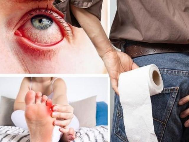 Sức khỏe đời sống - Những triệu chứng của chủng Coronavirus mới, không phải là “3 triệu chứng cổ điển”