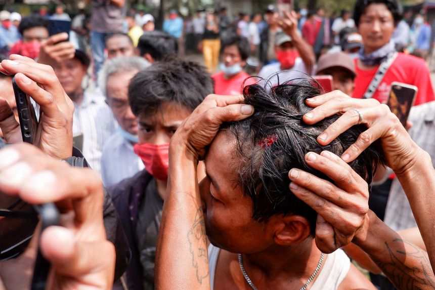 Một người biểu tình phản đối đảo chính ở Myanmar bị đạn cao su bắn trúng đầu (ảnh: Reuters)