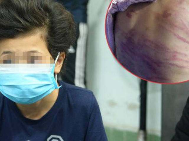 Hà Nội yêu cầu khẩn trương làm rõ vụ bé gái 12 tuổi ở Hà Đông nghi bị mẹ đẻ bạo hành dã man