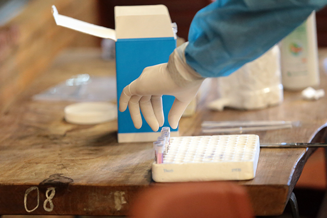 Các mẫu xét nghiệm tầm soát được đựng trong một ống nhỏ và xếp ngay ngắn trên khay.