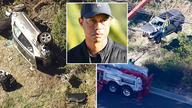 Siêu sao làng golf thế giới Tiger Woods vừa phải nhập viện vì bị gãy 2 chân sau khi tự gây ra vụ tai nạn lật xe ở Los Angeles (bang California, Mỹ) sáng 23/2