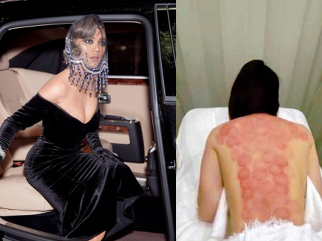 Đời sống Showbiz - Nữ "đại gia ngầm" có vòng 1 sexy nhất V-biz tung ảnh lưng trần nhưng ai nấy đều lo lắng