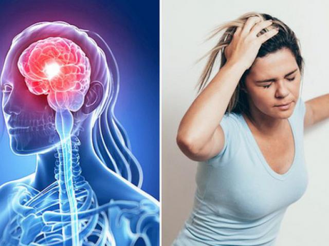 Media - Cảnh giác với những triệu chứng của bệnh đột quỵ não