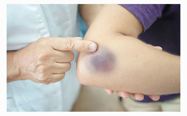 Chấn thương là vấn đề xảy ra thường xuyên trong sinh hoạt