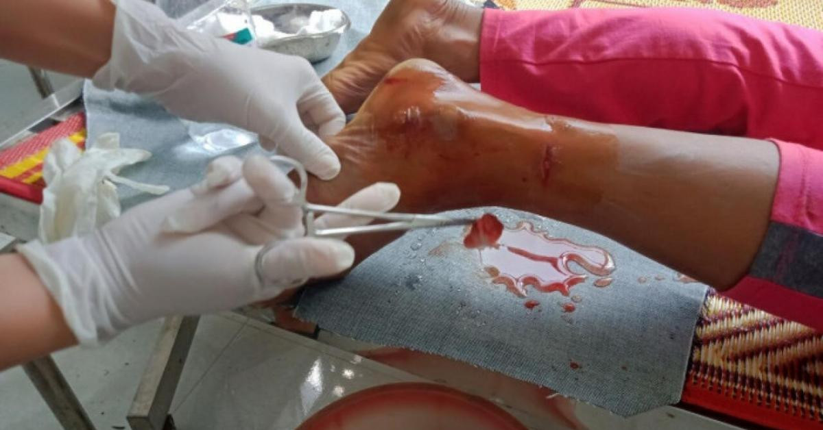 Tin tức trong ngày - Hy hữu: Đàn voọc tấn công người đi xe máy, cắn 18 người trên đường