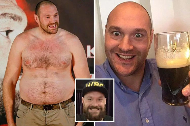 Tyson Fury bỏ bê tập luyện và uống bia thay cơm