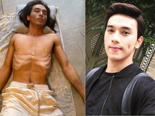 Giải trí - Sao nam Việt lộ ảnh "da bọc xương" ở tuổi 29 gây sốc