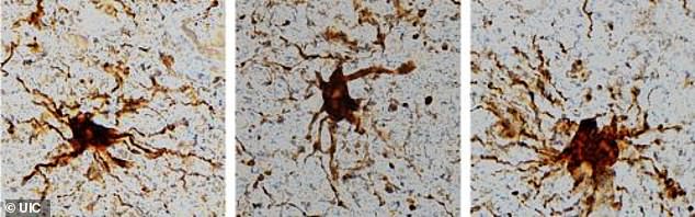 Các nhà nghiên cứu phát hiện một số tế bào não vẫn hoạt động khi con người chết.