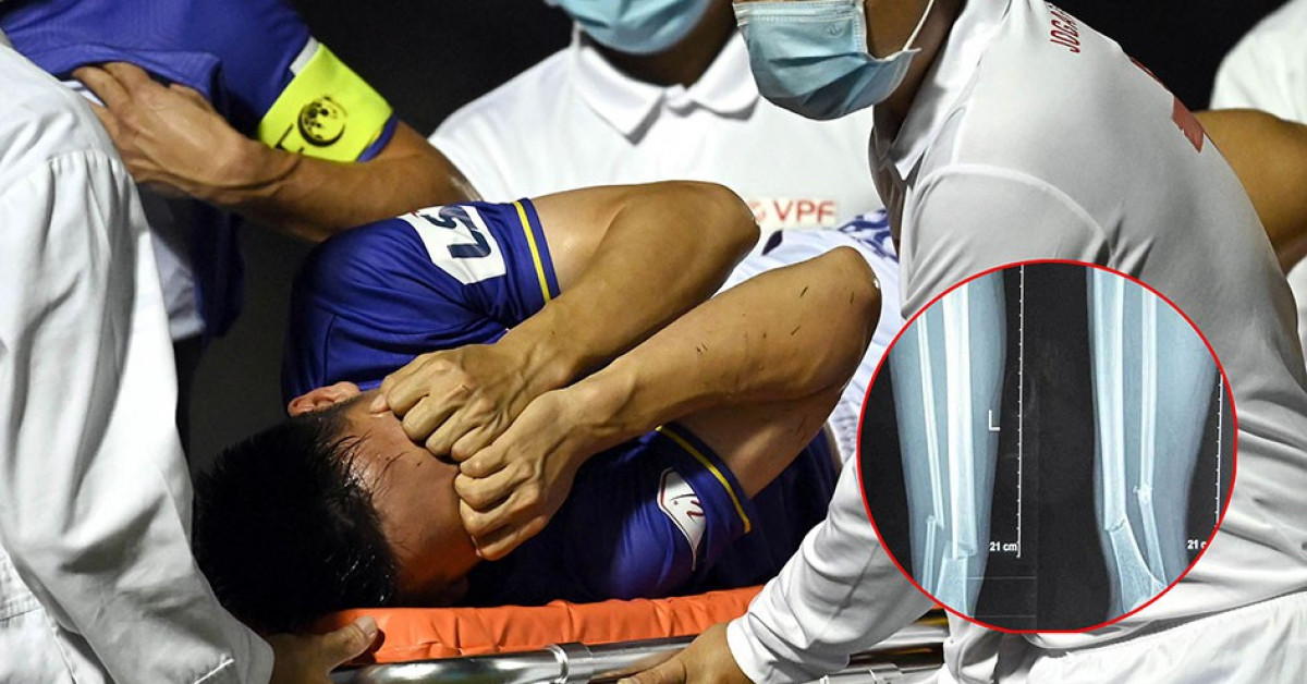 Bóng đá - Người chiến binh thầm lặng và nước mắt thầy Park