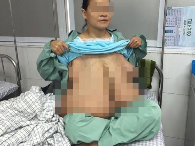 Cuộc sống của người đàn bà có “ngực dài quá rốn” giờ ra sao?
