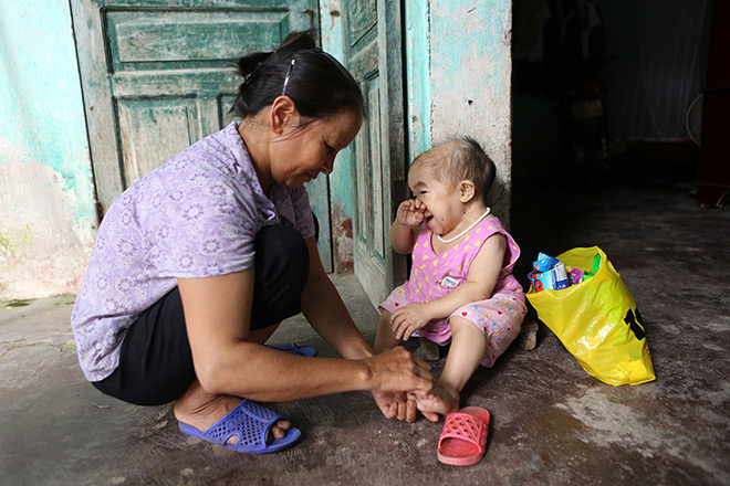  Bà Nguyễn và cô con gái không bao giờ lớn của mình. Ảnh: Việt Linh.