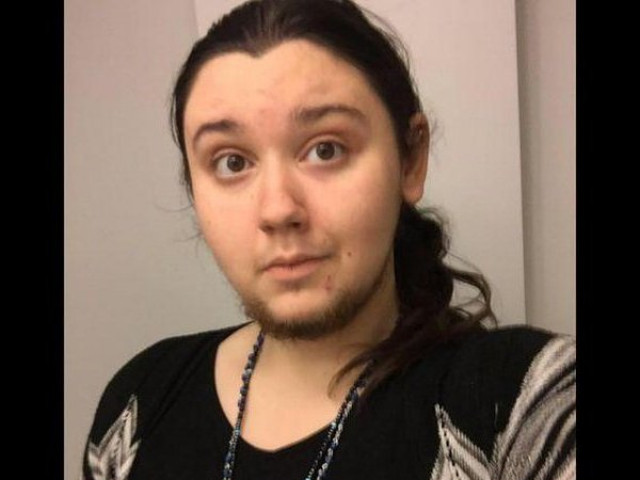 Bạn trẻ - Cuộc sống - Cô gái để râu rậm rạp như đàn ông suốt 12 năm