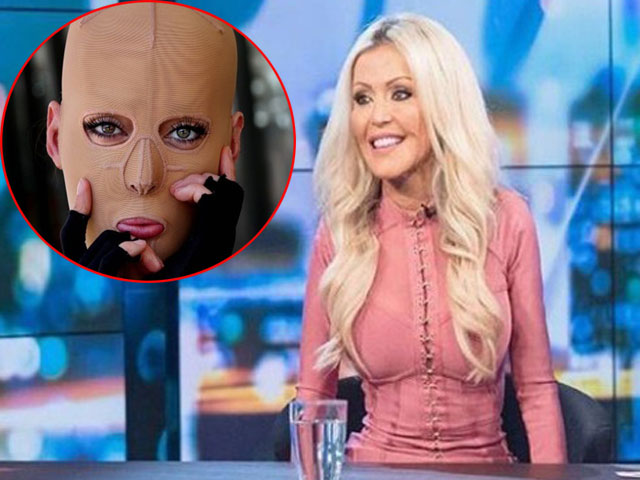 Bạn trẻ - Cuộc sống - Vướng hiểu lầm là "tiểu tam", cô gái bị tạt axit đến mức hủy hoại dung nhan, hồi sinh kỳ diệu sau 9 năm