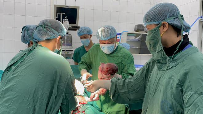 Tại phòng mổ của bệnh viện "công dân nhí" Trà My ở Ba Đình, Hà Nội chào đời nặng 3,1 kg