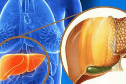 Sức khỏe đời sống - 6 nhóm thực phẩm người bị bệnh gan nhiễm mỡ nên tránh, món nguy cơ cao lại khoái khẩu của nhiều người