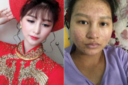 Bạn trẻ - Cuộc sống - Nhan sắc tàn tạ khi sinh nở, cô gái được chồng chuyển tiền tới tấp 'đền bù'