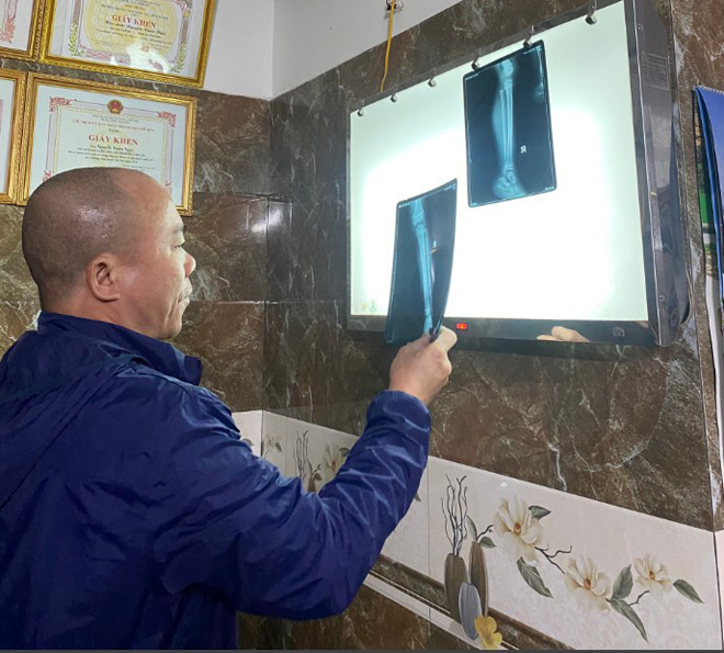 Lương y Nguyễn Xuân Ngọc đang nghiên cứu kết quả X-quang của bệnh nhân