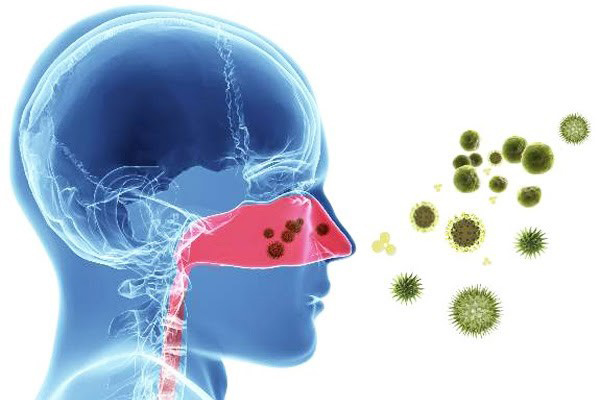 Viêm mũi thông thường chủ yếu do virus, vi khuẩn gây ra