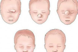 Sức khỏe đời sống - Hôn nhân cận huyết thống : 9 căn bệnh di truyền nguy hiểm mà đứa trẻ sinh ra có thể mắc