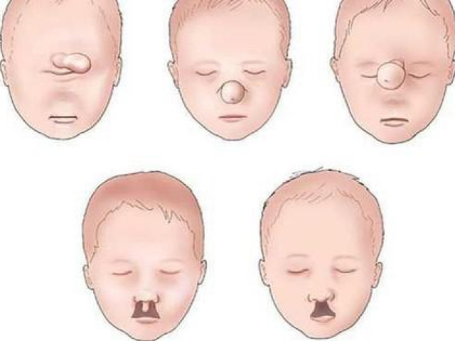 Sức khỏe đời sống - Hôn nhân cận huyết thống : 9 căn bệnh di truyền nguy hiểm mà đứa trẻ sinh ra có thể mắc