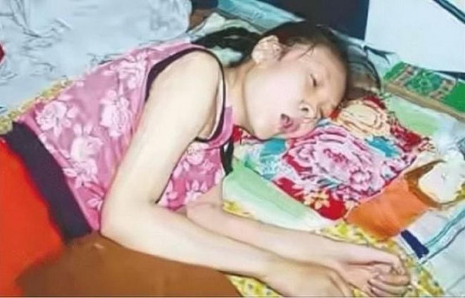Người phụ nữ giả bại liệt, nằm bẹp trên giường suốt 20 năm. Ảnh: Toutiao