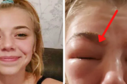 Sức khỏe đời sống - Thiếu nữ khóc ngất vì mắt sưng húp, chảy dịch sau khi nhuộm lông mày, nối mi