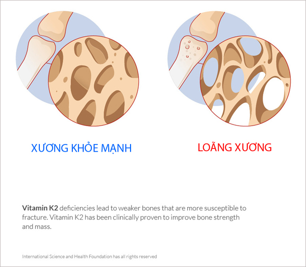 Not only helping children increase optimal height, here are 3 rare benefits that make you have to supplement vitamin K2 right away!  - 2