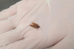 Phi thường - kỳ quặc - Cảm thấy kỳ lạ ở bên tai suốt 3 ngày, bất ngờ với thứ bác sĩ lấy ra