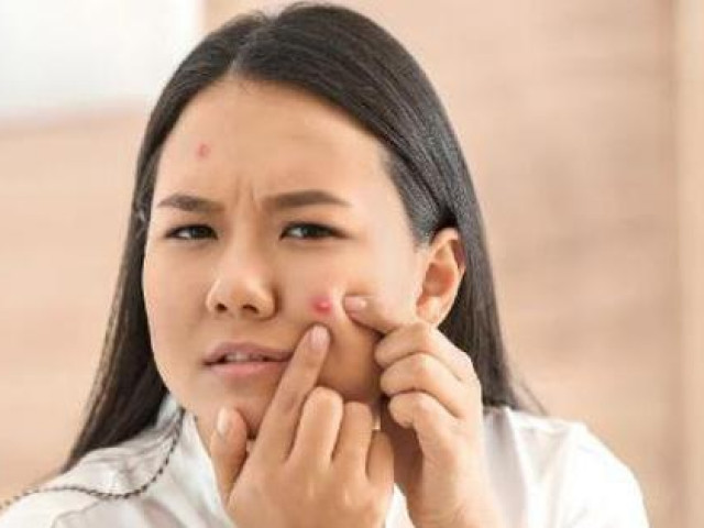 Làm đẹp - Đắp 5 thứ này lên mặt có thể hủy hoại làn da của bạn